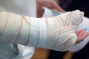 Nightstick fracture compensation calculator guide