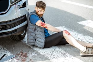 Learn About Using An MIB Compensation Calculator Injured man leaning against car with multiple and severe injuries that are bleeding.